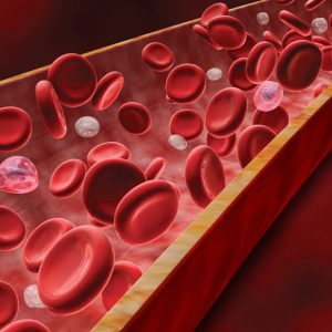 Evidências demonstram que cerca de 50% dos doentes com insuficiência cardíaca grave têm anemia